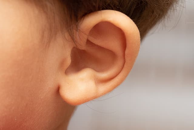 先天性耳瘻孔とは