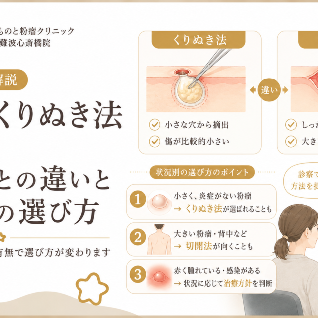 粉瘤のくりぬき法とは？切開法との違いと状況別の選び方