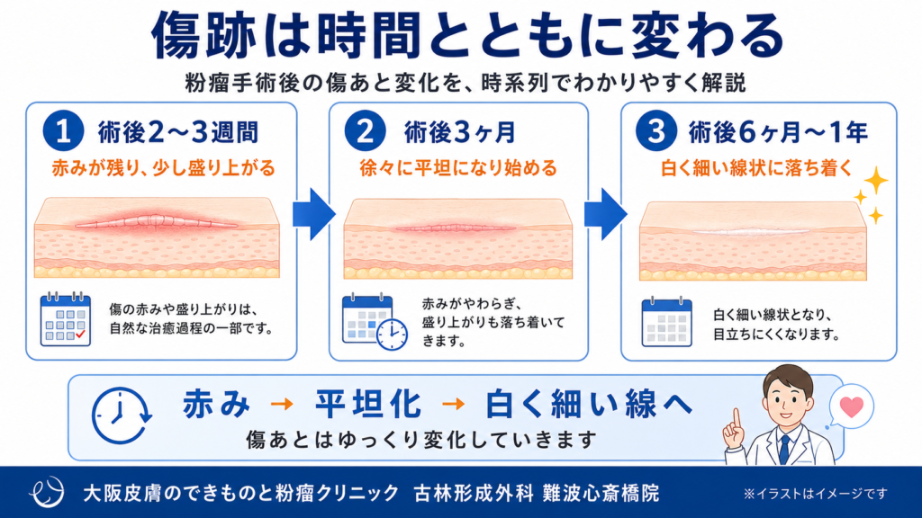 傷口の治癒過程